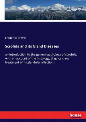 Scrofula and its Gland Diseases de Frederick Treves