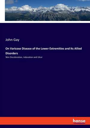 On Varicose Disease of the Lower Extremities and Its Allied Disorders de John Gay