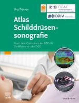 Atlas Schilddrüsensonografie de Jörg Bojunga