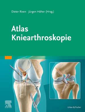 Atlas Kniearthroskopie de Dieter Rixen