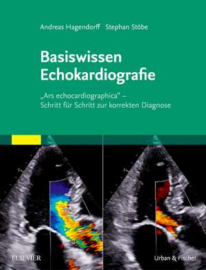 Basiswissen Echokardiografie de Andreas Hagendorff