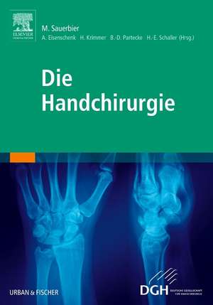 Die Handchirurgie de Andreas Eisenschenk