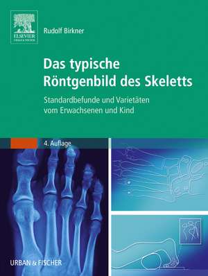 Das typische Röntgenbild des Skeletts de Rudolf Birkner