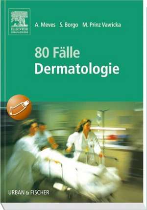 80 Fälle Dermatologie de Alexander Meves