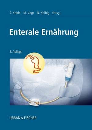 Enterale Ernährung: Indikationen, Sondierungstechniken, Diätetik, Pflege de Sigrid Kalde
