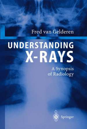 Understanding X-Rays: A Synopsis of Radiology de Fred van Gelderen