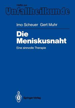 Die Meniskusnaht: Eine sinnvolle Therapie de Imo Scheuer