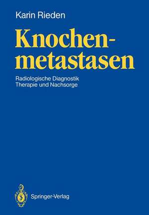 Knochenmetastasen: Radiologische Diagnostik, Therapie und Nachsorge de Karin Rieden