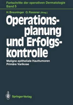 Operationsplanung und Erfolgskontrolle de Helmut Breuninger