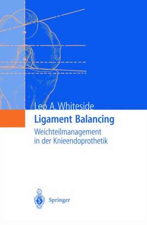 Ligament Balancing: Weichteilmanagement in der Knieendoprothetik de Leo A. Whiteside