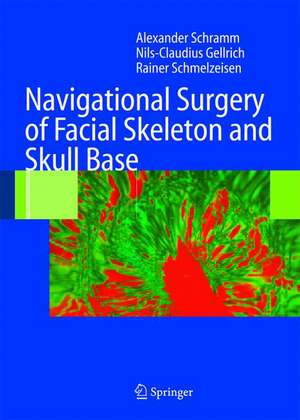 Navigational Surgery of the Facial Skeleton de Alexander Schramm