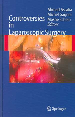 Controversies in Laparoscopic Surgery de Ahmad Assalia