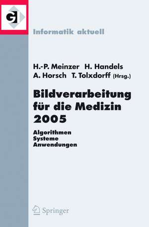 Bildverarbeitung für die Medizin 2005: Algorithmen - Systeme - Anwendungen, Proceedings des Workshops vom 13. - 15. März 2005 in Heidelberg de Hans-Peter Meinzer