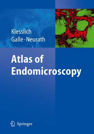 Atlas of Endomicroscopy de Ralf Kiesslich