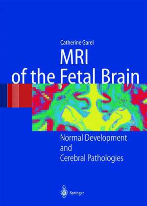 MRI of the Fetal Brain: Normal Development and Cerebral Pathologies de C. Garel