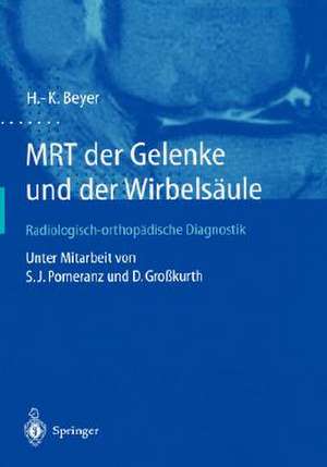 Mrt Der Gelenke Und Der Wirbelsaule