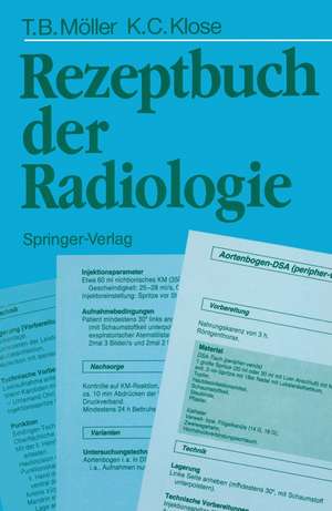 Rezeptbuch der Radiologie de Torsten B. Möller