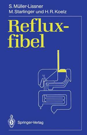 Refluxfibel de Stefan Müller-Lissner