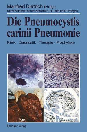 Die Pneumocystis carinii Pneumonie: Klinik · Diagnostik · Therapie · Prophylaxe de N. Konietzko