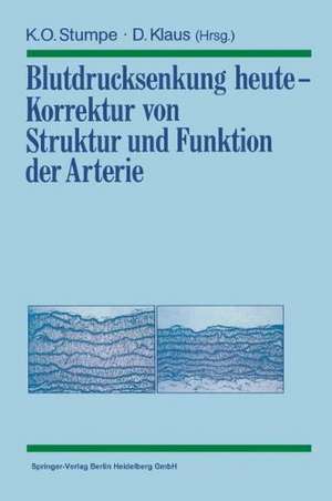 Blutdrucksenkung heute — Korrektur von Struktur und Funktion der Arterie de Klaus O. Stumpe