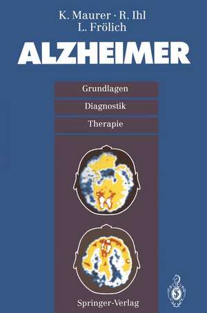 Alzheimer: Grundlagen, Diganostik, Therapie de K. Maurer