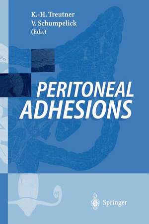 Peritoneal Adhesions de Karl-Heinz Treutner