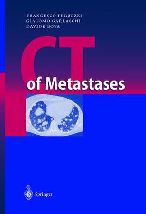 CT of Metastases de Francesco Ferrozzi