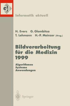 Bildverarbeitung für die Medizin 1999: Algorithmen — Systeme — Anwendungen Proceedings des Workshops am 4. und 5. März 1999 in Heidelberg de Harald Ewers