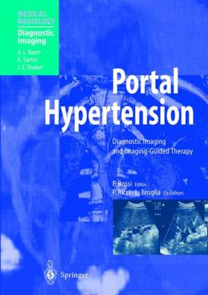 Portal Hypertension