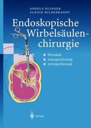 Endoskopische Wirbelsaulenchirurgie