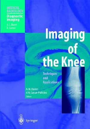 Imaging of the Knee