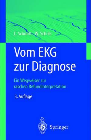 Vom EKG zur Diagnose: Ein Wegweiser zur raschen Befundinterpretation de Claus Schmitt