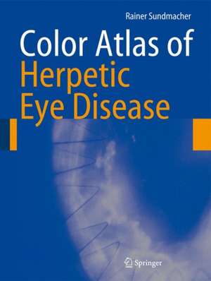 Color Atlas of Herpetic Eye Disease: A Practical Guide to Clinical Management de Rainer Sundmacher