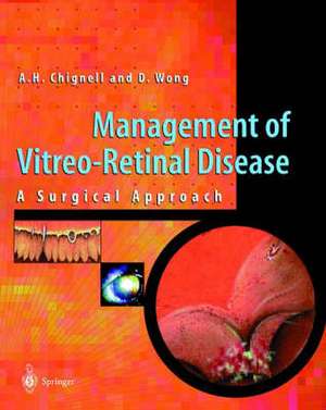 Management of Vitreo-Retinal Disease: A Surgical Approach de Anthony Chignell