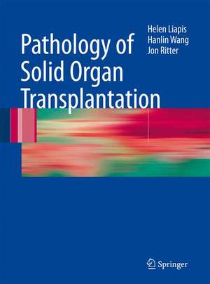 Pathology of Solid Organ Transplantation de Helen Liapis