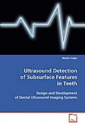 Ultrasound Detection of Subsurface Features in Teeth de Martin Culjat