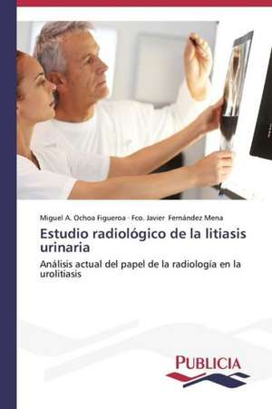 Estudio Radiologico de La Litiasis Urinaria: Emilio Carrere y Edgar Neville de Miguel A. Ochoa Figueroa