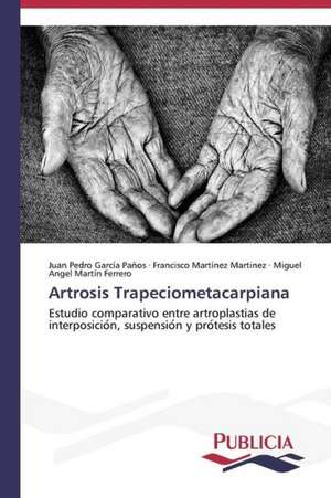 Artrosis Trapeciometacarpiana de Juan Pedro Garcia Paños