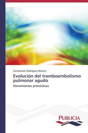 Evolucion del Tromboembolismo Pulmonar Agudo: Un Ilustrado En Tiempos de Oscuridad de Consolación Rodríguez-Matute