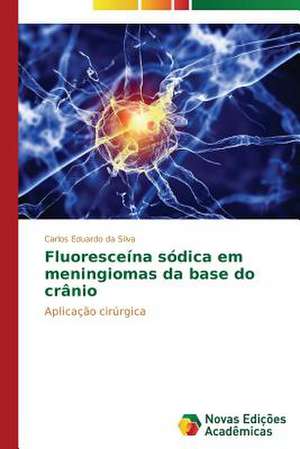 Fluoresceina Sodica Em Meningiomas Da Base Do Cranio: Educ de Carlos Eduardo da Silva