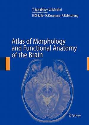 Atlas of Morphology and Functional Anatomy of the Brain de T. Scarabino