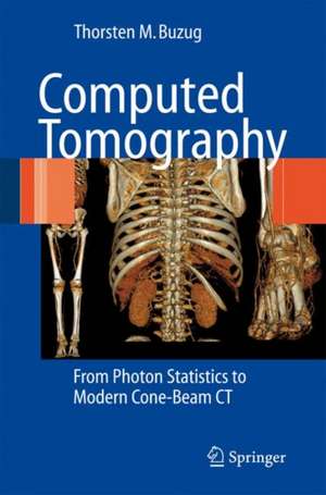 Computed Tomography: From Photon Statistics to Modern Cone-Beam CT de Thorsten M. Buzug