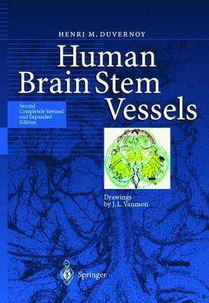 Human Brain Stem Vessels: Including the Pineal Gland and Information on Brain Stem Infarction de J. Guyot