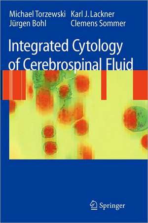 Integrated Cytology of Cerebrospinal Fluid de Michael Torzewski