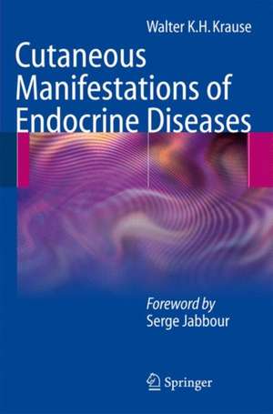 Cutaneous Manifestations of Endocrine Diseases de Walter K.H. Krause