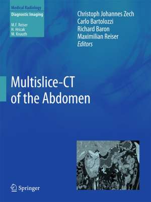 Multislice-CT of the Abdomen de Christoph Johannes Zech