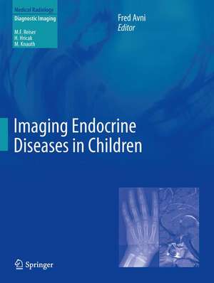 Imaging Endocrine Diseases in Children de Fred Avni