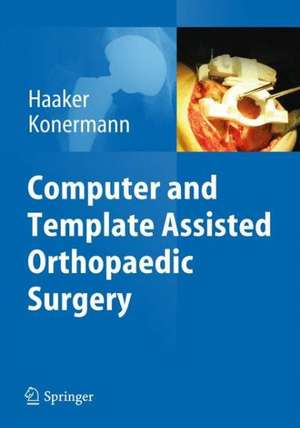 Computer and Template Assisted Orthopedic Surgery de Rolf Haaker