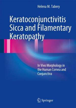 Keratoconjunctivitis Sicca and Filamentary Keratopathy: In Vivo Morphology in the Human Cornea and Conjunctiva de Helena M. Tabery