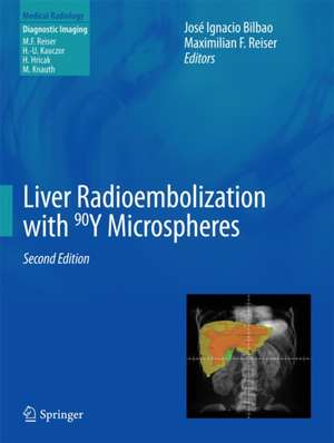 Liver Radioembolization with 90Y Microspheres de José Ignacio Bilbao